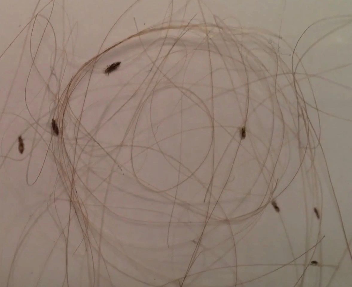 Can I Get Lice From The Bed? (1.5 min. video worth your time!)